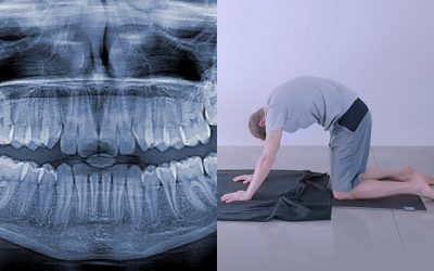 Spinal Flossing